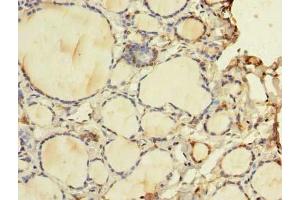 Immunohistochemistry of paraffin-embedded human thyroid tissue using ABIN7175757 at dilution of 1:100 (WDR49 抗体  (AA 251-500))