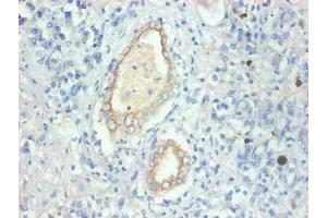 Immunohistochemical of paraffin-embedded human kidney tissue using ABIN7152614 at dilution of 1:200 (FABP3 抗体)