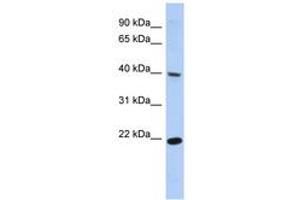 Image no. 1 for anti-Single Stranded DNA Binding Protein 4 (SSBP4) (C-Term) antibody (ABIN6742646) (SSBP4 抗体  (C-Term))