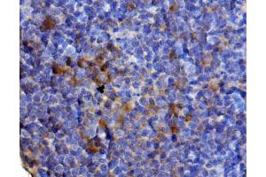 IHC analysis of Il13 using anti-Il13 antibody (ABIN7600672).