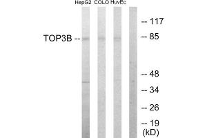 Western blot analysis of extracts from HepG2 cells, COLO205 cells and HUVEC cells, using TOP3B antibody. (TOP3B 抗体  (N-Term))