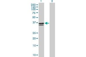 Western Blot analysis of ST3GAL2 expression in transfected 293T cell line by ST3GAL2 MaxPab polyclonal antibody.