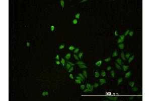 Immunofluorescence of monoclonal antibody to CD58 on HeLa cell. (CD58 抗体  (AA 1-240))