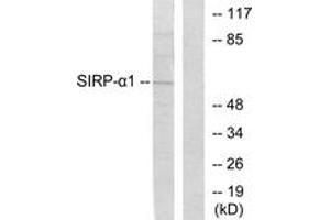 Western blot analysis of extracts from HepG2 cells, using Sirp alpha1 Antibody. (SIRPA 抗体  (AA 451-500))