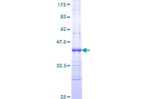 TSC1 Protein (AA 166-274) (GST tag)