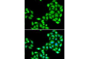 Immunofluorescence analysis of A549 cell using OGFR antibody. (OGFR 抗体)