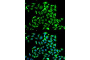 Immunofluorescence analysis of A549 cell using CLASP1 antibody. (CLASP1 抗体)