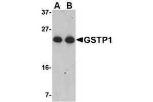 Western blot analysis of GSTP1 in Jurkat cell lysate with AP30389PU-N GSTP1 antibody at (A) 0. (GSTP1 抗体  (Center))