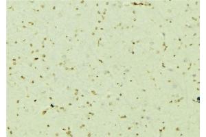 ABIN6276710 at 1/100 staining Mouse brain tissue by IHC-P. (PSMC5 抗体  (Internal Region))