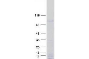 Validation with Western Blot
