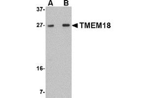 Western Blotting (WB) image for anti-Transmembrane Protein 18 (TMM18) (C-Term) antibody (ABIN1030748) (Transmembrane Protein 18 (TMM18) (C-Term) 抗体)