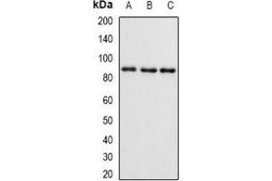 Western blot analysis of SMYD4 expression in mouse brain (A), mouse ovary (B), rat kidney (C) whole cell lysates. (SMYD4 抗体)