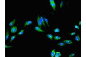 Immunofluorescent analysis of Hela cells using ABIN7174670 at dilution of 1:100 and Alexa Fluor 488-congugated AffiniPure Goat Anti-Rabbit IgG(H+L) (UFSP2 抗体  (AA 63-343))