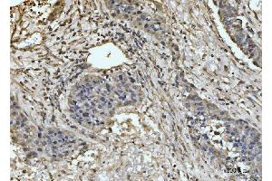 IHC analysis of EXOSC8 using anti-EXOSC8 antibody (ABIN7601850).