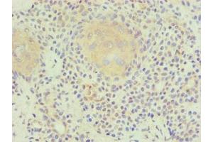 Immunohistochemistry (IHC) image for anti-Lipoprotein-Associated phospholipase A2 (Lp-PLA2) antibody (ABIN7176818)