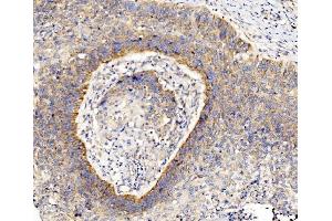 IHC analysis of RPL8 using anti-RPL8 antibody (ABIN7601179). (RPL8 抗体  (AA 3-257))