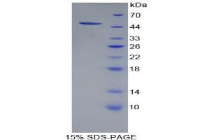 SDS-PAGE analysis of Human PSMC4 Protein.
