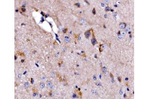 IHC analysis of ATG9A using anti-ATG9A antibody (ABIN7600676). (ATG9A 抗体  (AA 22-169))