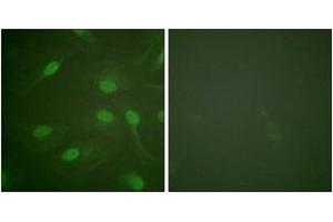 Immunofluorescence analysis of HeLa cells, using Chk1 (Phospho-Ser301) Antibody. (CHEK1 抗体  (pSer301))