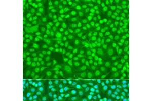 Immunofluorescence analysis of U2OS cells using SFRS9 Polyclonal Antibody at dilution of 1:100. (SFRS9 抗体)