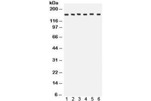 Western blot testing of 1) rat brain, 2) rat liver, 3) human HeLa, 4) CEM, 5) A549 and 6) MCF7 lysate with ROCK2 antibody. (ROCK2 抗体  (AA 652-923))