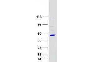 Western Blotting (WB) image for Actin Related Protein 2/3 Complex, Subunit 2, 34kDa (ARPC2) (Transcript Variant 2) protein (Myc-DYKDDDDK Tag) (ABIN2714940)