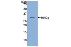 Detection of Recombinant ATXN1, Human using Polyclonal Antibody to Ataxin 1 (ATXN1) (Ataxin 1 抗体  (AA 569-807))