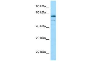 Western Blotting (WB) image for anti-Dihydropyrimidinase-Like 4 (DPYSL4) (C-Term) antibody (ABIN2790103) (DPYSL4 抗体  (C-Term))