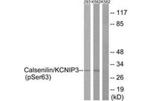 Western Blotting (WB) image for anti-Kv Channel Interacting Protein 3, Calsenilin (KCNIP3) (AA 29-78), (pSer63) antibody (ABIN1531643)
