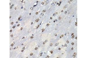 Immunohistochemistry (Paraffin-embedded Sections) (IHC (p)) image for anti-Proteasome (Prosome, Macropain) Subunit, beta Type 10 (PSMB10) antibody (ABIN7261409)