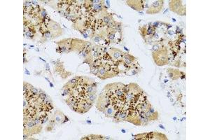 Immunohistochemistry of paraffin-embedded Human stomach using CHIC2 Polyclonal Antibody at dilution of 1:100 (40x lens). (CHIC2 抗体)