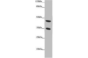 Western blot All lanes: TENT5C antibody at 2 μg/mL + Mouse heart tissue Secondary Goat polyclonal to rabbit IgG at 1/10000 dilution Predicted band size: 45 kDa Observed band size: 45, 35 kDa (FAM46C 抗体  (AA 1-391))