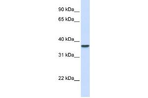 Western Blotting (WB) image for anti-Dimethylarginine Dimethylaminohydrolase 1 (DDAH1) antibody (ABIN2459821) (DDAH1 抗体)