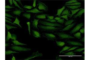 Immunofluorescence of purified MaxPab antibody to ProSAPiP1 on HeLa cell. (ProSAPiP1 抗体  (AA 1-673))