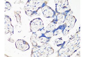 Immunohistochemistry of paraffin-embedded human placenta using MMP2 Antibody (ABIN5998246) at dilution of 1/100 (40x lens). (MMP2 抗体)