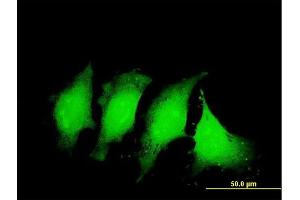 Immunofluorescence of monoclonal antibody to IL1B on HeLa cell. (IL-1 beta 抗体  (AA 170-269))