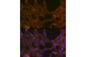 Immunofluorescence (IF) image for anti-Activin A Receptor, Type IB (ACVR1B) antibody (ABIN1678826)