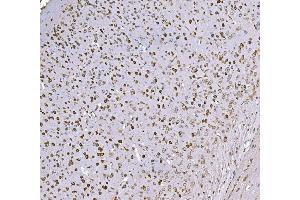 IHC analysis of SND1 using anti-SND1 antibody (ABIN7600526). (SND1 抗体  (AA 20-204))