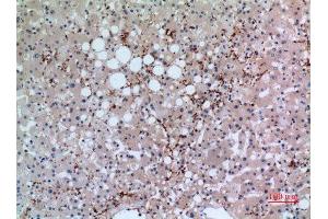 Immunohistochemistry (IHC) analysis of paraffin-embedded Human Liver, antibody was diluted at 1:100.