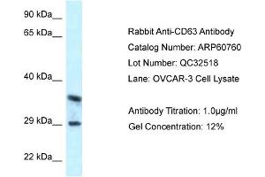 Sample Type: OVCAR3 cell lysateAntibody Titration: 1. (CD63 抗体  (C-Term))