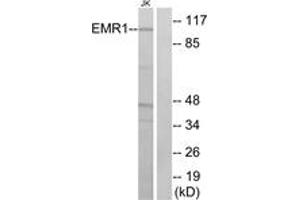 Western blot analysis of extracts from Jurkat cells, using EMR1 Antibody. (F4/80 抗体  (AA 818-867))
