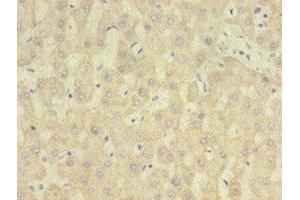 Immunohistochemistry of paraffin-embedded human liver tissue using ABIN7167807 at dilution of 1:100 (Chemerin 抗体  (AA 21-157))