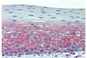 Immunohistochemistry staining of human tonsil (paraffin-embedded sections) with anti-CD82 (C33). (CD82 抗体)
