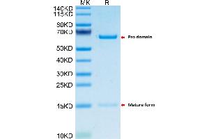 PCSK9 Protein (AA 35-694) (His tag)