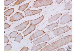 Formalin-fixed and paraffin embedded rat skeletal muscle labeled with Anti Phospho-SEK1/MKK4 (Thr261) Polyclonal Antibody, Unconjugated (ABIN702745) at 1:200 followed by conjugation to the secondary antibody and DAB staining (MAP2K4 抗体  (pThr261))