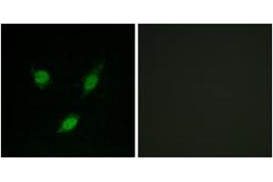 Immunofluorescence analysis of MCF7 cells, using TACC1 Antibody. (TACC1 抗体  (AA 11-60))
