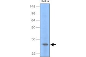 Western blot analysis of cell lysate of HeLa (30 ug) were resolved by SDS - PAGE , transferred to PVDF membrane and probed with UNG monoclonal antibody , clone k1C12 (1 : 1000) . (UNG 抗体)