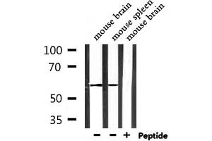 Western Blotting (WB) image for anti-Signal Transducing Adaptor Molecule (SH3 Domain and ITAM Motif) 2 (STAM2) antibody (ABIN6265306)