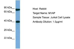 Host: Rabbit Target Name: M1AP Sample Type: Jurkat Whole Cell lysates Antibody Dilution: 1. (Meiosis 1 Associated Protein (M1AP) (Middle Region) 抗体)