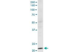 NDUFV2 monoclonal antibody (M03), clone 1A10. (NDUFV2 抗体  (AA 150-249))